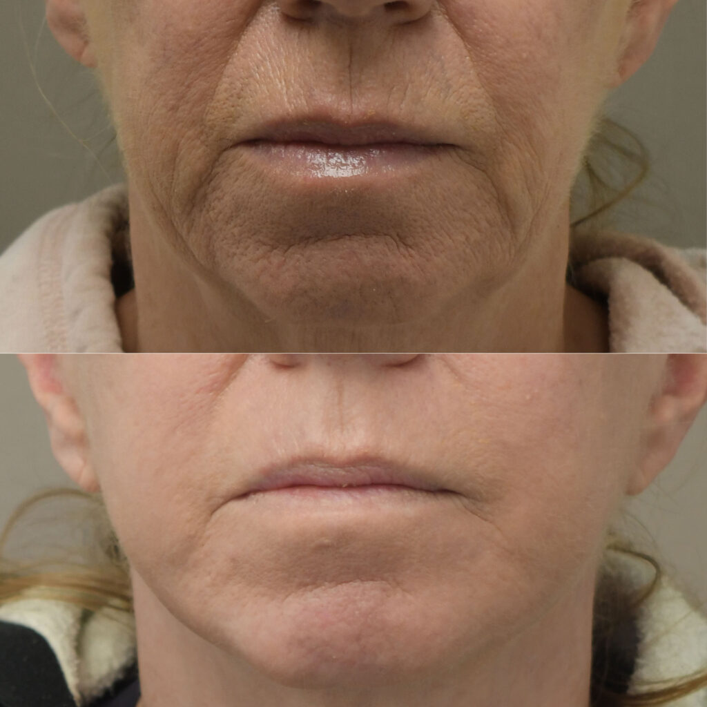 Case Of Month I Dr.Afshin Parhiscar