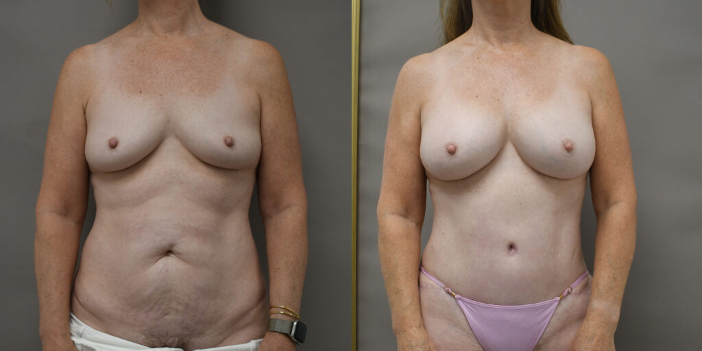 Case Of Month I Dr.Afshin Parhiscar