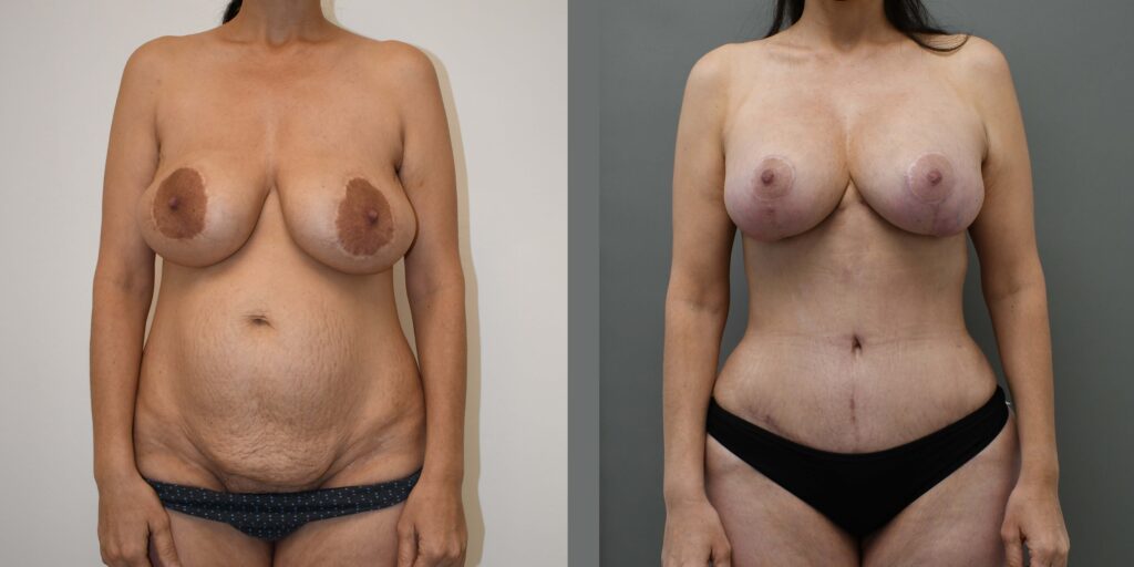 Case Of Month I Dr.Afshin Parhiscar