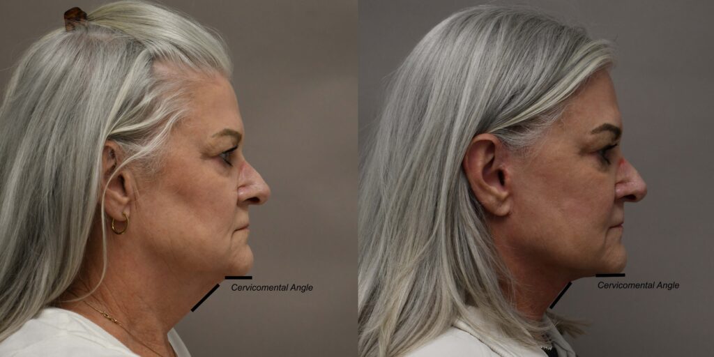 Case Of Month I Dr.Afshin Parhiscar