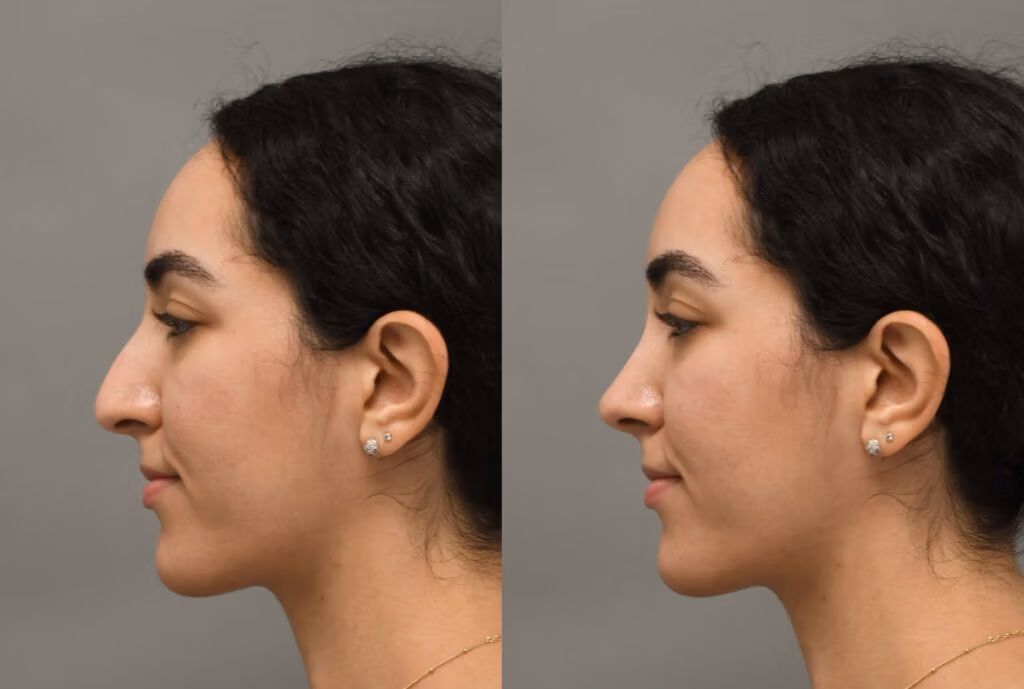 Case Of Month I Dr.Afshin Parhiscar