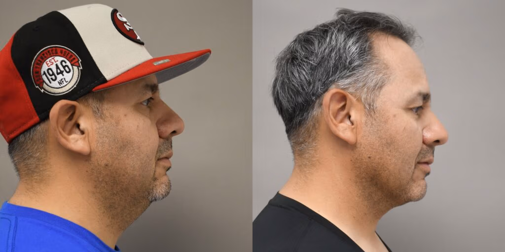 Case Of Month I Dr.Afshin Parhiscar
